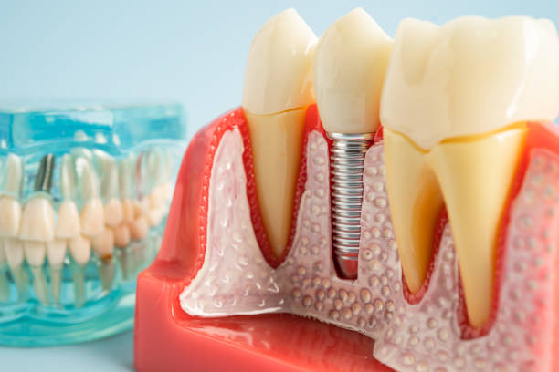 Best Dental Inlays and Onlays  in Ralls, TX